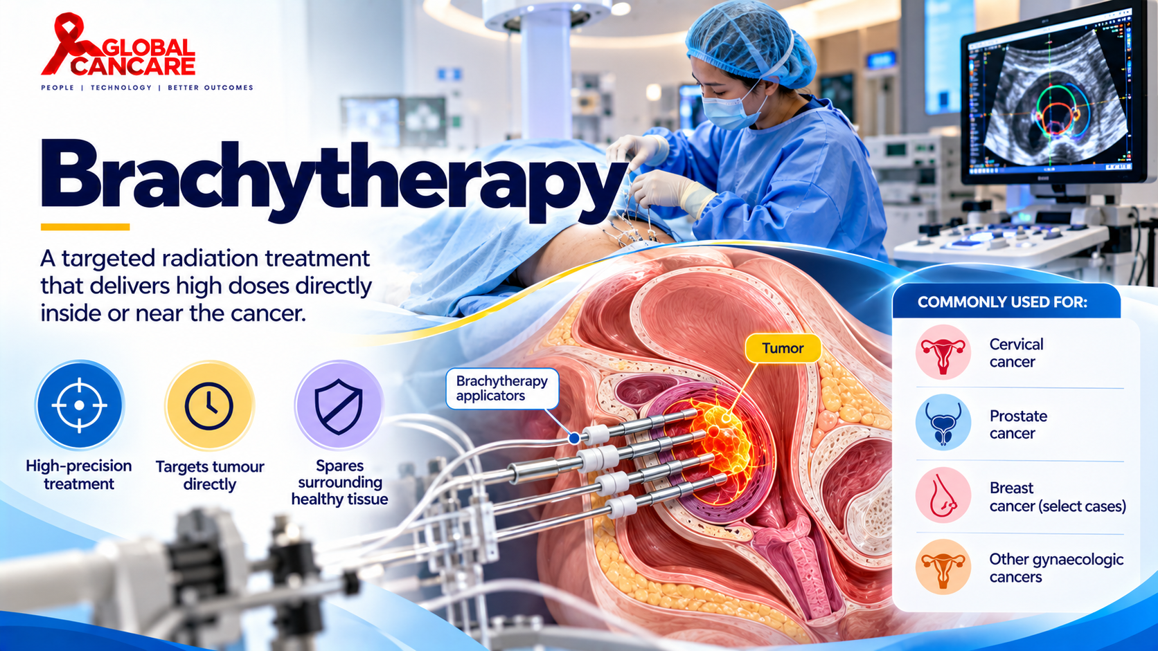 Brachytherapy_ Precision Cancer Care.png
